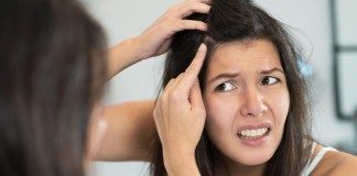 How to Remove Dandruff