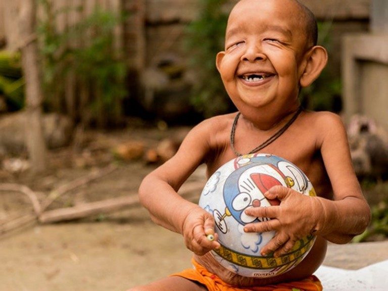 ចម្លែក ! អាយុ ៤ឆ្នាំសោះមុខដូចតាចាស់ ៨០ឆ្នាំ